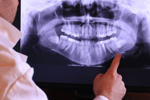 Best Urgent Tooth Repair  in Bling, AR