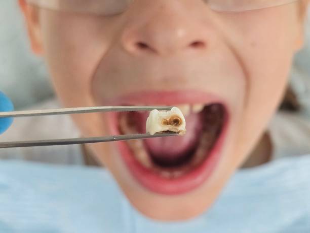 Best Tooth Pain Emergency Relief  in Bling, AR